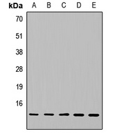 NDUFA5 Rabbit Polyclonal Antibody