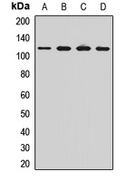 OSBP Rabbit Polyclonal Antibody