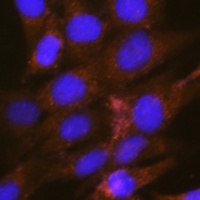 OSBP Rabbit Polyclonal Antibody
