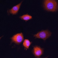 PGAM1 Rabbit Polyclonal Antibody