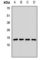 RPL23A Rabbit Polyclonal Antibody