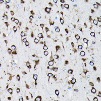 RPL23A Rabbit Polyclonal Antibody