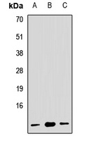 RPL19 Rabbit Polyclonal Antibody