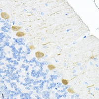 RPL19 Rabbit Polyclonal Antibody