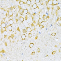 VARS Rabbit Polyclonal Antibody