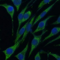VARS Rabbit Polyclonal Antibody