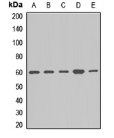 APPBP1 Rabbit Polyclonal Antibody
