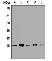 EIF1AY Rabbit Polyclonal Antibody