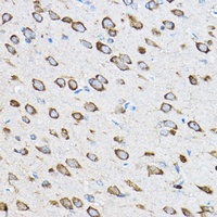 RPL23 Antibody