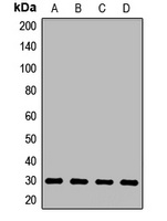 PQBP1 Rabbit Polyclonal Antibody
