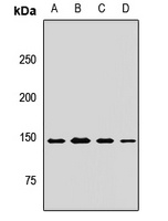 MYBBP1A Rabbit Polyclonal Antibody