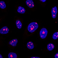 MYBBP1A Rabbit Polyclonal Antibody