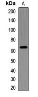 IGF2BP3 Antibody