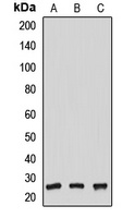 NUDT21 Rabbit Polyclonal Antibody