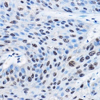 NUDT21 Rabbit Polyclonal Antibody