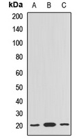 BLOC1S6 Rabbit Polyclonal Antibody