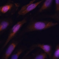 E2 EPF Rabbit Polyclonal Antibody