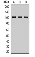 PIDD Rabbit Polyclonal Antibody