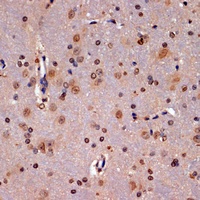 PIDD Rabbit Polyclonal Antibody