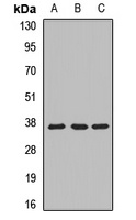 MRPL1 Rabbit Polyclonal Antibody