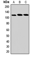 DHX36 Rabbit Polyclonal Antibody