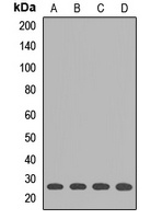 GSTK1 Rabbit Polyclonal Antibody