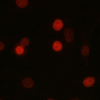 SETD8 Rabbit Polyclonal Antibody