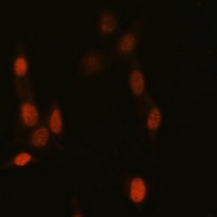 Histone H3 (TriMethyl-K14) Antibody