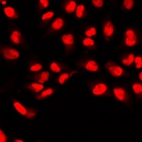 ID3 Rabbit Polyclonal Antibody