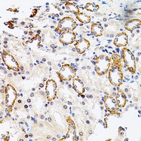 RSK2 Antibody