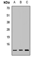 MGP Rabbit Polyclonal Antibody