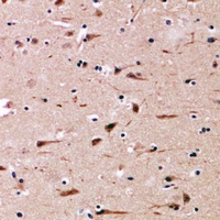 MGP Rabbit Polyclonal Antibody