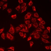 Myoglobin Rabbit Polyclonal Antibody