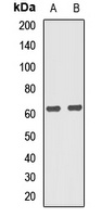 PPP2R5C Rabbit Polyclonal Antibody