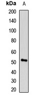 UMPS Rabbit Polyclonal Antibody