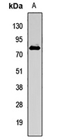 FUBP1 Rabbit Polyclonal Antibody