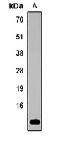 GNRH1 Rabbit Polyclonal Antibody