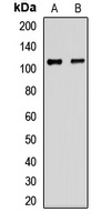 EPC1 Rabbit Polyclonal Antibody