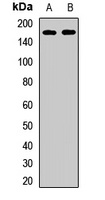 Kinectin 1 Rabbit Polyclonal Antibody