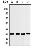ILF2 Rabbit Polyclonal Antibody