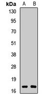 RBM3 Rabbit Polyclonal Antibody