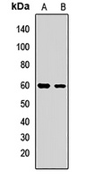 MetaP2 Rabbit Polyclonal Antibody