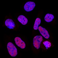 CPSF6 Rabbit Polyclonal Antibody