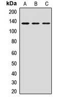 HTATSF1 Rabbit Polyclonal Antibody