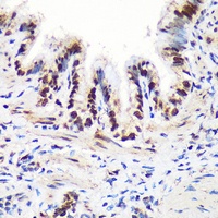 THOC4 Rabbit Polyclonal Antibody