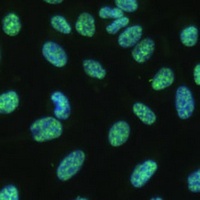 THOC4 Rabbit Polyclonal Antibody