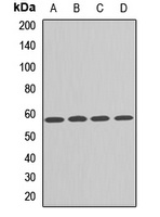 PRPF4 Rabbit Polyclonal Antibody
