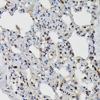 PRPF4 Rabbit Polyclonal Antibody