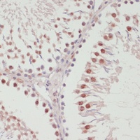 SNRNP70 Rabbit Polyclonal Antibody