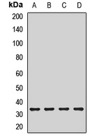 AKTIP Rabbit Polyclonal Antibody
